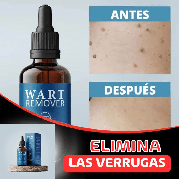 REMOVEDOR DE VERRUGAS Y LUNARES